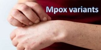 France Confirms First Case of New Mpox Variant Clade 1B: Health Officials on Alert New Mpox Variant